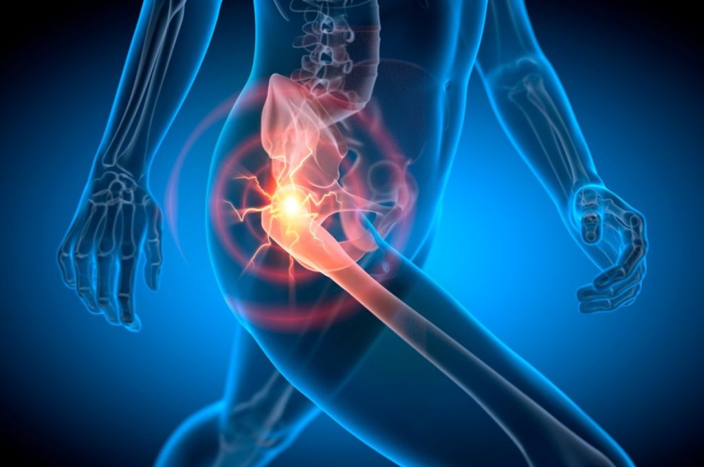 Hip Pain While Walking or Sitting: How Can Physiotherapy Help